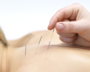 acupuntura-11